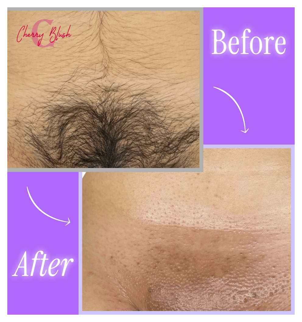 BareGlow™ Skin Perfecting Wand