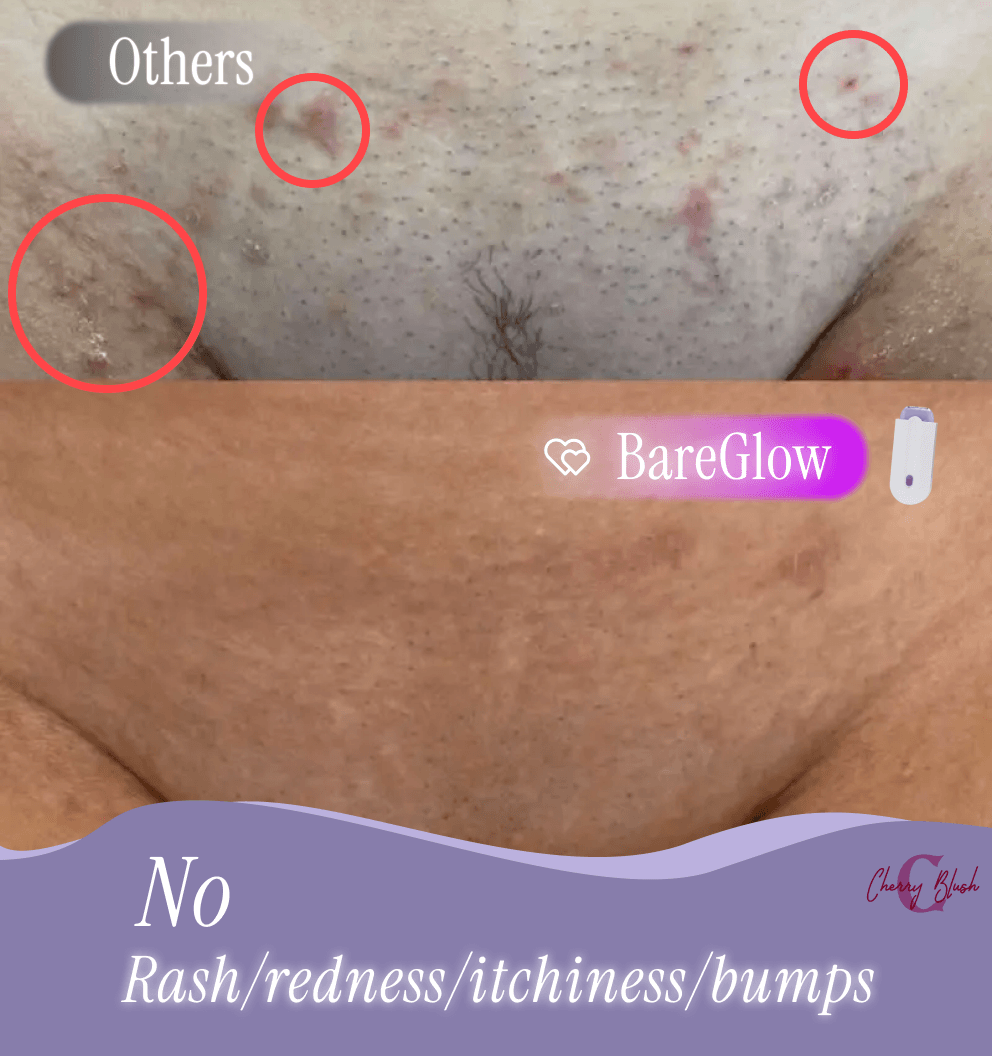 BareGlow™ Skin Perfecting Wand